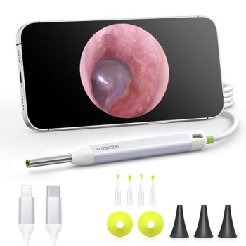 AnyScope HD Digital Otoscope, Video Ear Scope Otoscope with Light