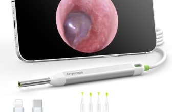 AnyScope HD Digital Otoscope, Video Ear Scope Otoscope with Light