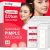 Sosky Pimple Patches for Face, Invisible Hydrocolloid Acne Patches